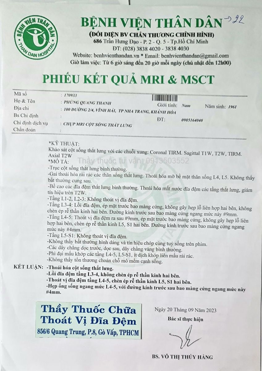 Thoát vị đĩa đệm cột sống lưng